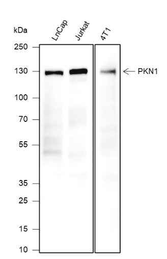 Anti-Human/Mouse PKN1 Antibody [A335]