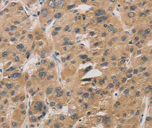 Anti-Human/Mouse/Rat DDIT4 Antibody