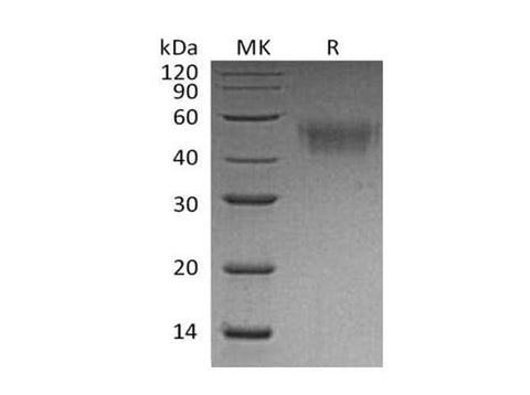 Recombinant Mouse CD64/FCGR1 Protein (His Tag) - ABMIUM