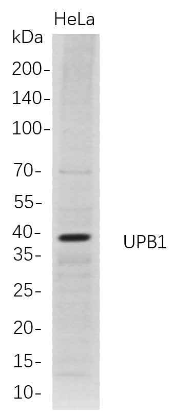 Anti-Human UPB1 Antibody [B715] - ABMIUM