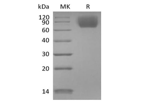 Recombinant Mouse TrkC/Ntrk3 (C-6His) - ABMIUM