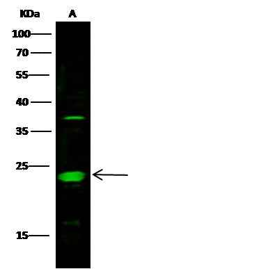 Anti-Human MESD Antibody [B278] - ABMIUM