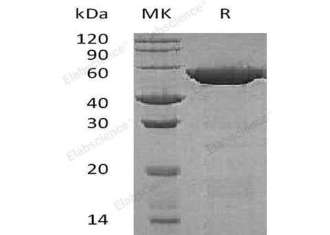 Recombinant Human GSS Protein (His Tag) - ABMIUM