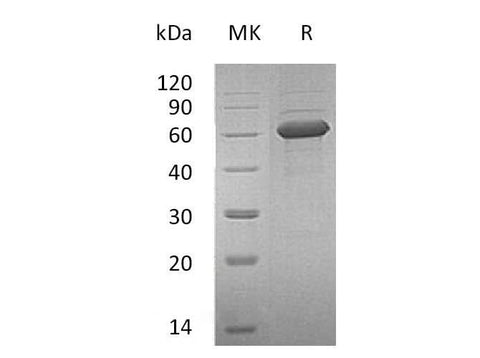 Recombinant Human NKG2DL/ULBP-1 Protein (Fc Tag) - ABMIUM