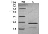 Recombinant Human HSPB7 Protein (His Tag) - ABMIUM