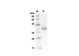 SDS-PAGE analysis of Human PRTN3 proteins, 2 μg/lane of Recombinant Human PRTN3 proteins was resolved with SDS-PAGE under reducing conditions, showing bands at 28 kDa.