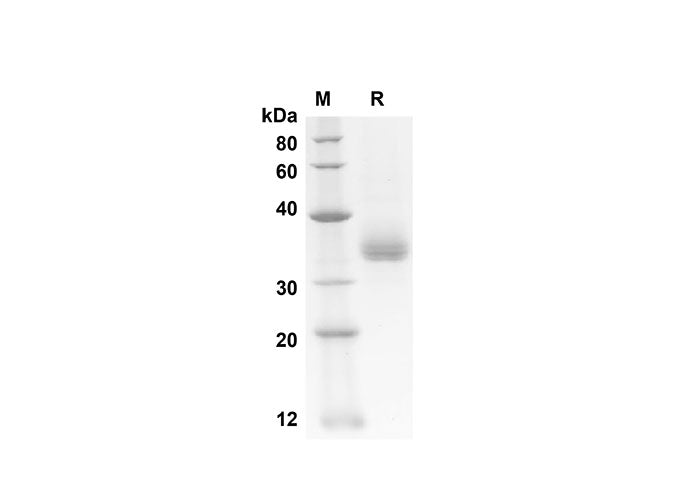 SDS-PAGE analysis of Human PRTN3 proteins, 2 μg/lane of Recombinant Human PRTN3 proteins was resolved with SDS-PAGE under reducing conditions, showing bands at 28 kDa.