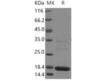 Recombinant Human MAGOH Protein (His Tag) - ABMIUM