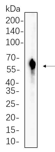 Anti-Human/Mouse/Rat RAGE Antibody [B540] - ABMIUM