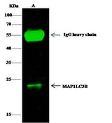 Anti-Human MAP1LC3B Antibody - ABMIUM