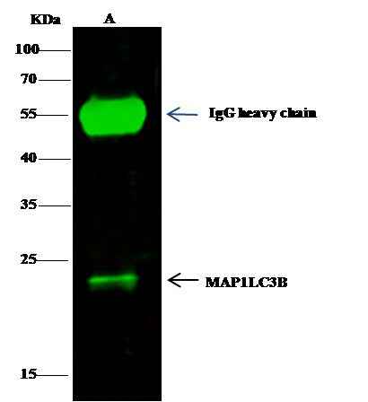 Anti-Human MAP1LC3B Antibody - ABMIUM