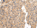 Anti-Human VAMP5 Antibody - ABMIUM