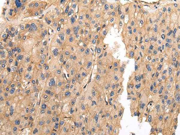Anti-Human VAMP5 Antibody