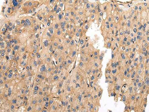 Anti-Human VAMP5 Antibody