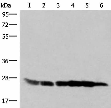 Western blot analysis of 293T HepG2 K562 HT29 A549 and Raji cell lysates using GSTK1 Polyclonal Antibody at dilution of 1:250