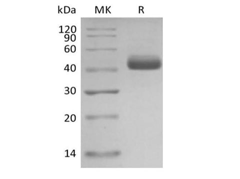 Recombinant Human Interleukin-5/IL-5 (C-mFc) - ABMIUM