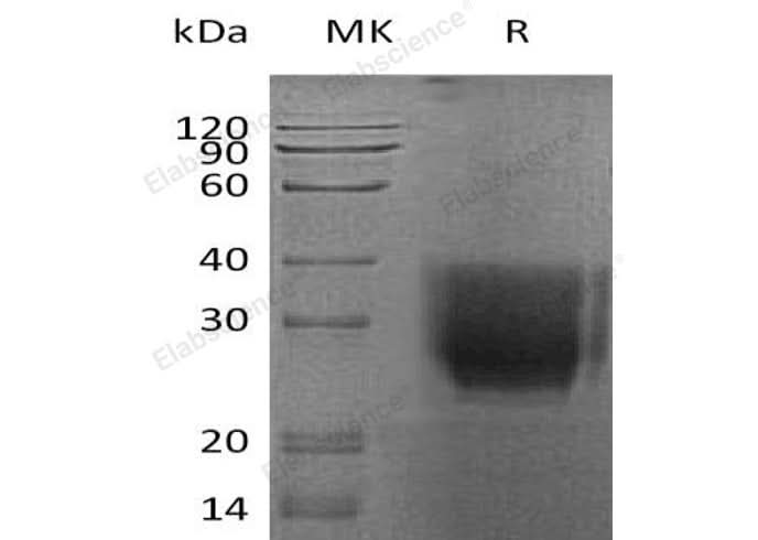Recombinant Human CD147/Basigin Protein (His Tag) - ABMIUM