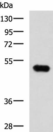 Western blot analysis of Mouse kidney tissue lysate using FOXQ1 Polyclonal Antibody at dilution of 1:750