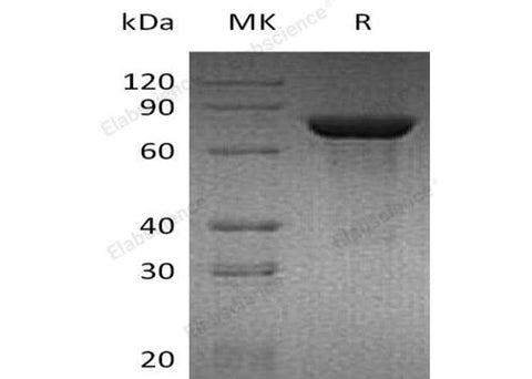 Recombinant Mouse TGM2/Transglutaminase 2 Protein (His Tag) - ABMIUM