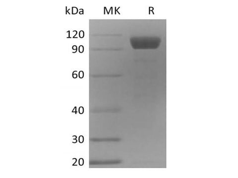 Recombinant Mouse Angiopoietin-2/ANG2 (C-Fc) - ABMIUM