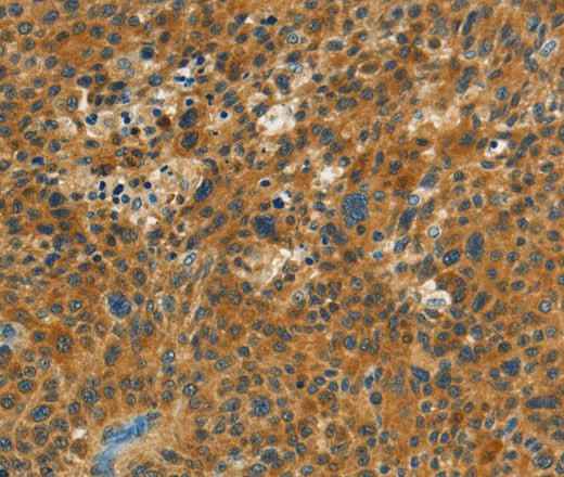 Anti-Human NPAP1 Antibody