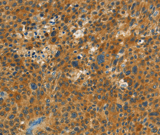 Anti-Human NPAP1 Antibody - ABMIUM