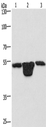 Anti-Human/Mouse/Rat PLEKHO1 Antibody - ABMIUM