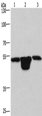Anti-Human/Mouse/Rat PLEKHO1 Antibody - ABMIUM