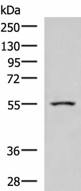 Western blot analysis of Human heart tissue lysate using ARIH2 Polyclonal Antibody at dilution of 1:1000