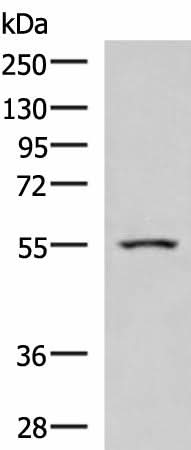 Western blot analysis of Human heart tissue lysate using ARIH2 Polyclonal Antibody at dilution of 1:1000