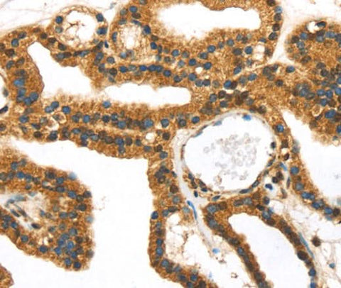 Anti-Human SERPINB8 Antibody - ABMIUM