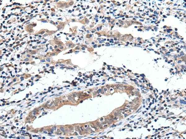 Anti-Human/Mouse ELMO1 Antibody