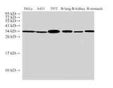 Western Blot analysis of 1)Hela, 2)A431, 3)293T, 4)Bovine lung, 5)Bovine kidney, 6)Bovine stomach using ANXA5 Polyclonal Antibody at dilution of 1:500