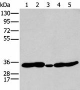 Western blot analysis of 231 Mouse heart tissue Human fetal brain tissue Jurkat and Hepg2 cell using HOXC11 Polyclonal Antibody at dilution of 1:250