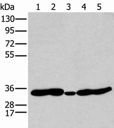 Western blot analysis of 231 Mouse heart tissue Human fetal brain tissue Jurkat and Hepg2 cell using HOXC11 Polyclonal Antibody at dilution of 1:250