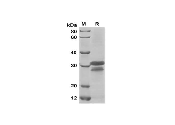 SDS-PAGE analysis of Mouse CCL3/MIP-1α proteins, 2 μg/lane of Recombinant Mouse CCL3/MIP-1α proteins was resolved with SDS-PAGE under reducing conditions, showing bands at 31 kDa.