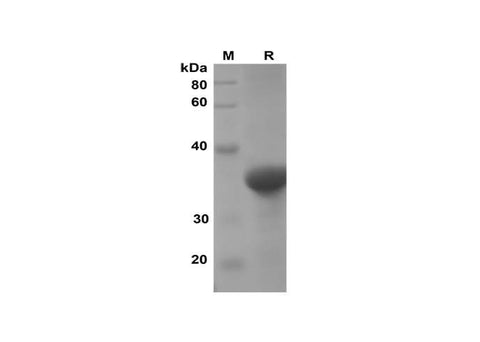 SDS-PAGE analysis of Rat IL-1b proteins, 2 μg/lane of Recombinant Rat IL-1b proteins was resolved with SDS-PAGE under reducing conditions, showing bands at 36 kDa.