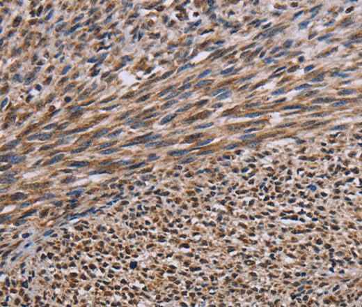 Anti-Human/Mouse/Rat KIF2A Antibody