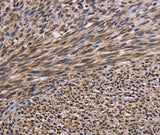 Anti-Human/Mouse/Rat KIF2A Antibody - ABMIUM