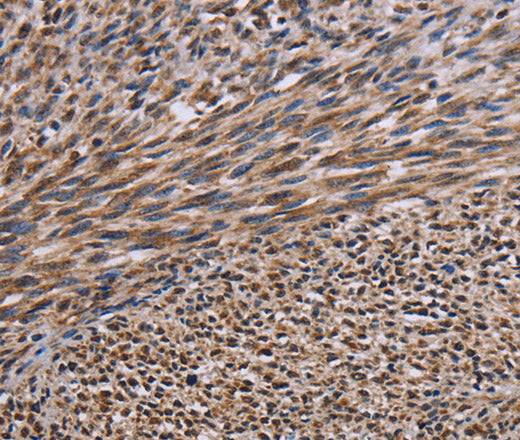 Anti-Human/Mouse/Rat KIF2A Antibody - ABMIUM