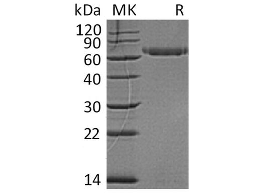 Recombinant Human LAG3/CD223 Protein (His Tag) - ABMIUM
