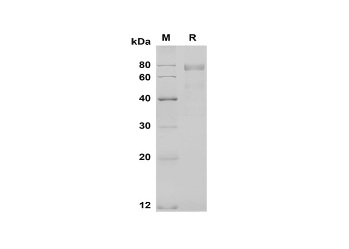 SDS-PAGE analysis of Mouse NOV/CCN3 proteins, 2 μg/lane of Recombinant Mouse NOV/CCN3 proteins was resolved with SDS-PAGE under reducing conditions, showing bands at 80 kDa.