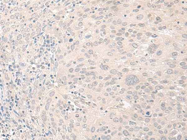 Anti-Human FOXRED2 Antibody