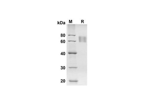 SDS-PAGE analysis of Human AXL/UFO proteins, 2 μg/lane of Recombinant Human AXL/UFO proteins was resolved with SDS-PAGE under reducing conditions, showing bands at 46.7 kDa.