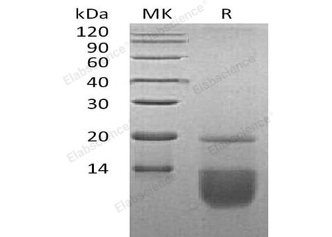Recombinant Human CCL3 Protein - ABMIUM