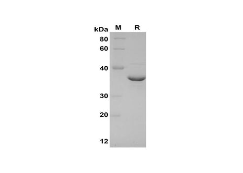 SDS-PAGE analysis of Mouse IL-17C proteins, 2 μg/lane of Recombinant Mouse IL-17C proteins was resolved with SDS-PAGE under reducing conditions, showing bands at 35 kDa.