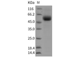 Recombinant Rat TGFBR2 Protein (Fc Tag) - ABMIUM