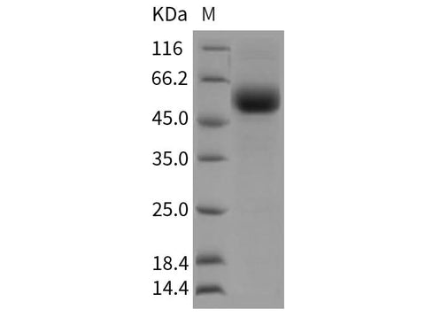 Recombinant Rat TGFBR2 Protein (Fc Tag) - ABMIUM