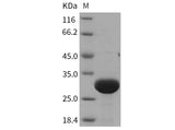> 95 % as determined by reducing SDS-PAGE.