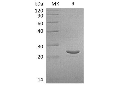 Recombinant Human GSTP1 Protein - ABMIUM